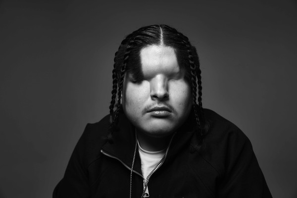 A black and white up-close portrait photo of blind trap artist Mattmac against a grey background.